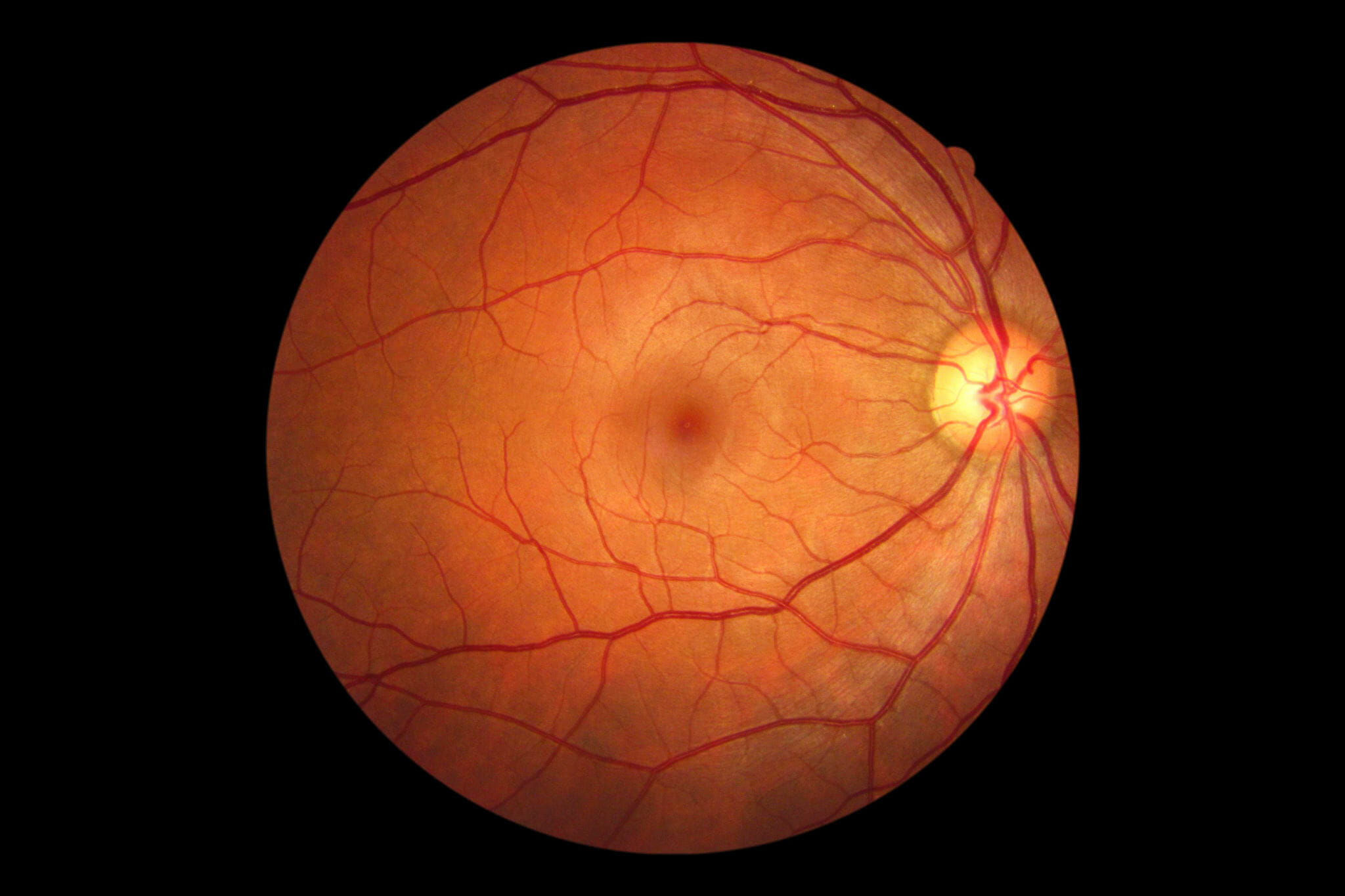 retina eye associates retina eye associates